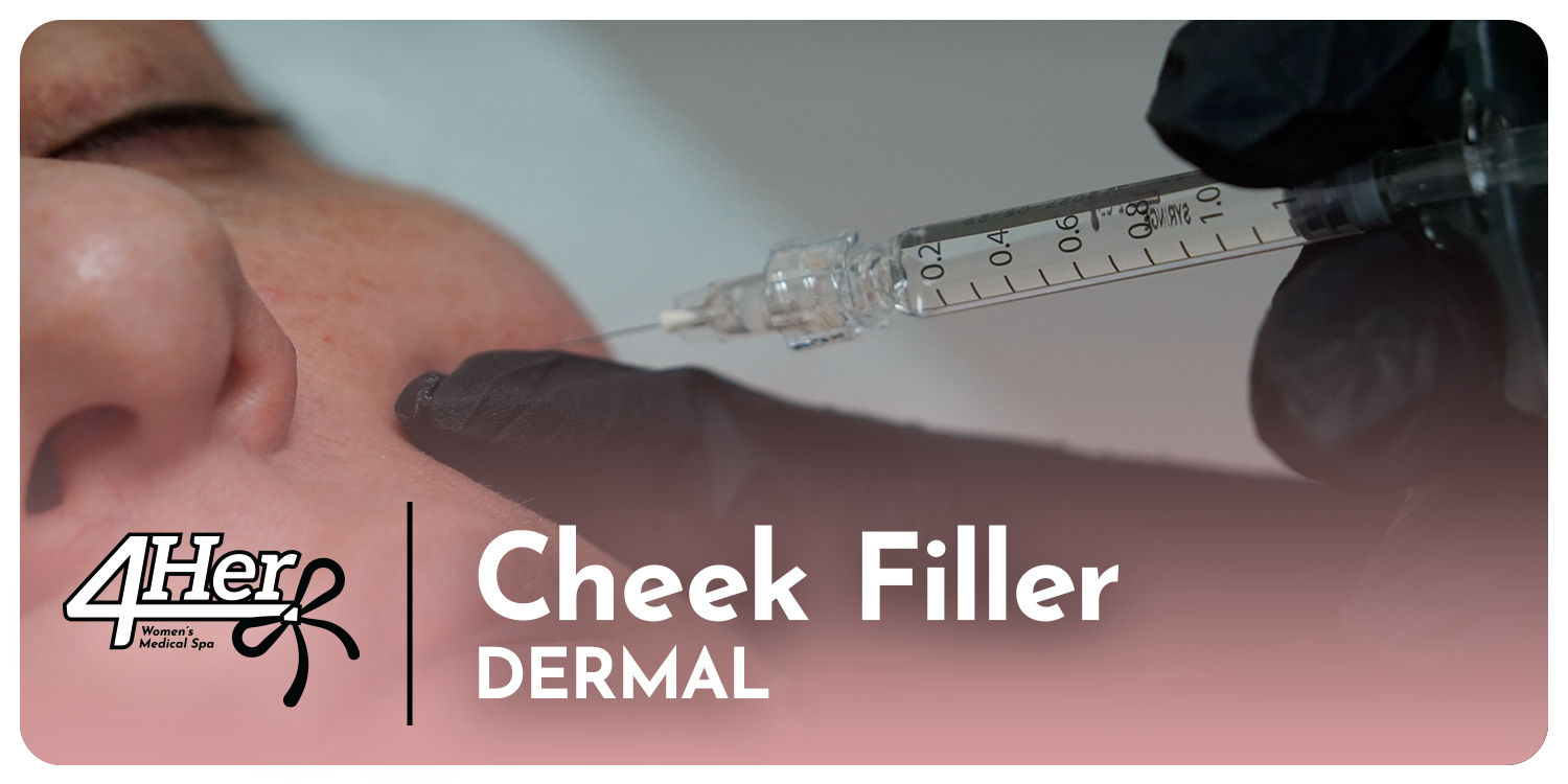 Cheek Filler