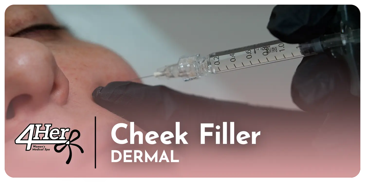 Cheek Filler 4Her Spa