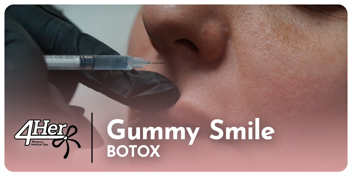 Gummy Smile 4Her Spa