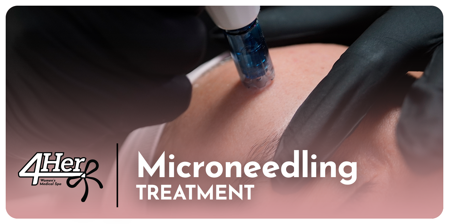 Microneedling Treatment