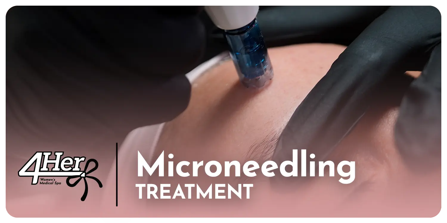 Microneedling Treatment 4Her Spa