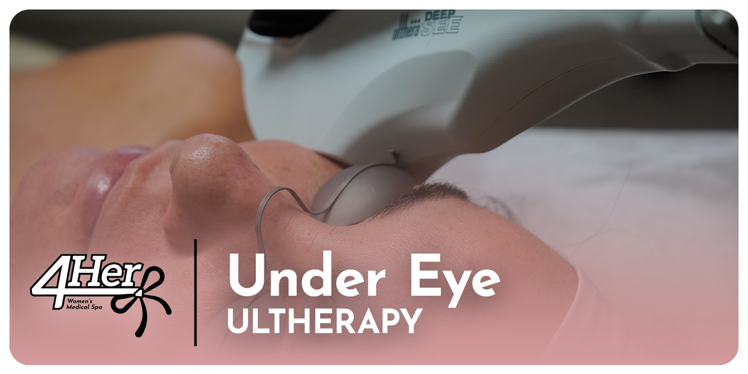 Ultherapy 4Her: Under Eye