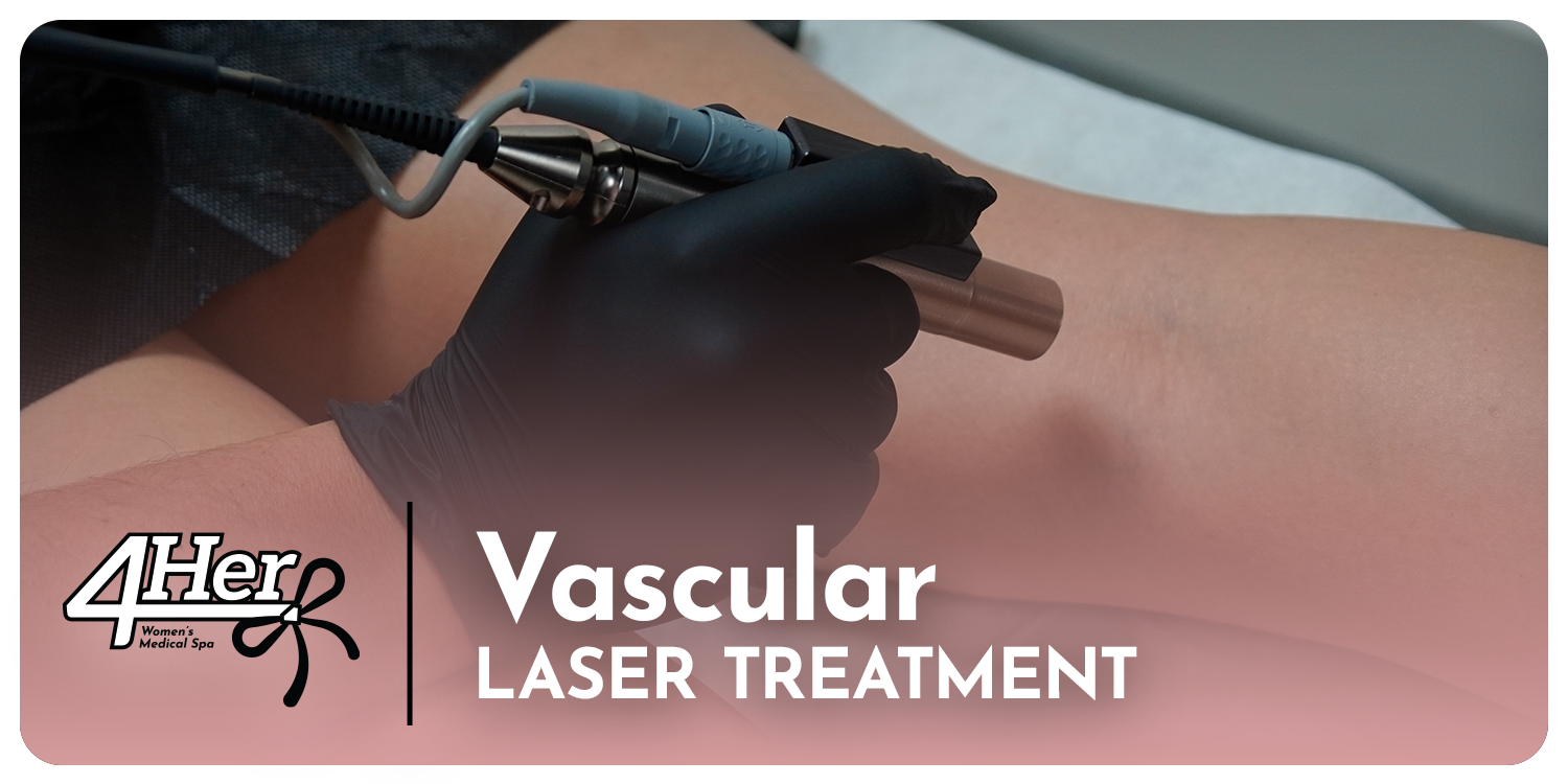 Vascular Laser Treatment for Women — 60-Minute Session