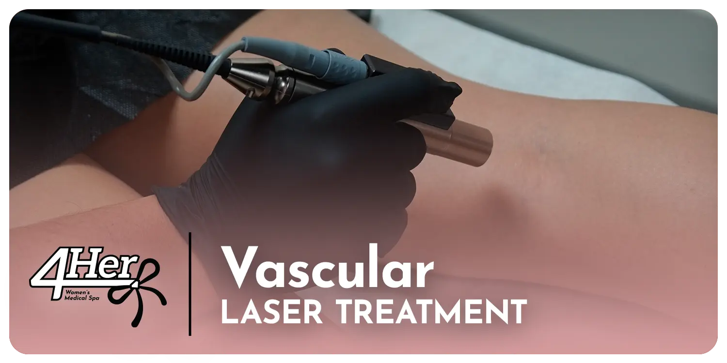 Vascular Laser Treatment for Women — 60-Minute Session SYR X 4Her