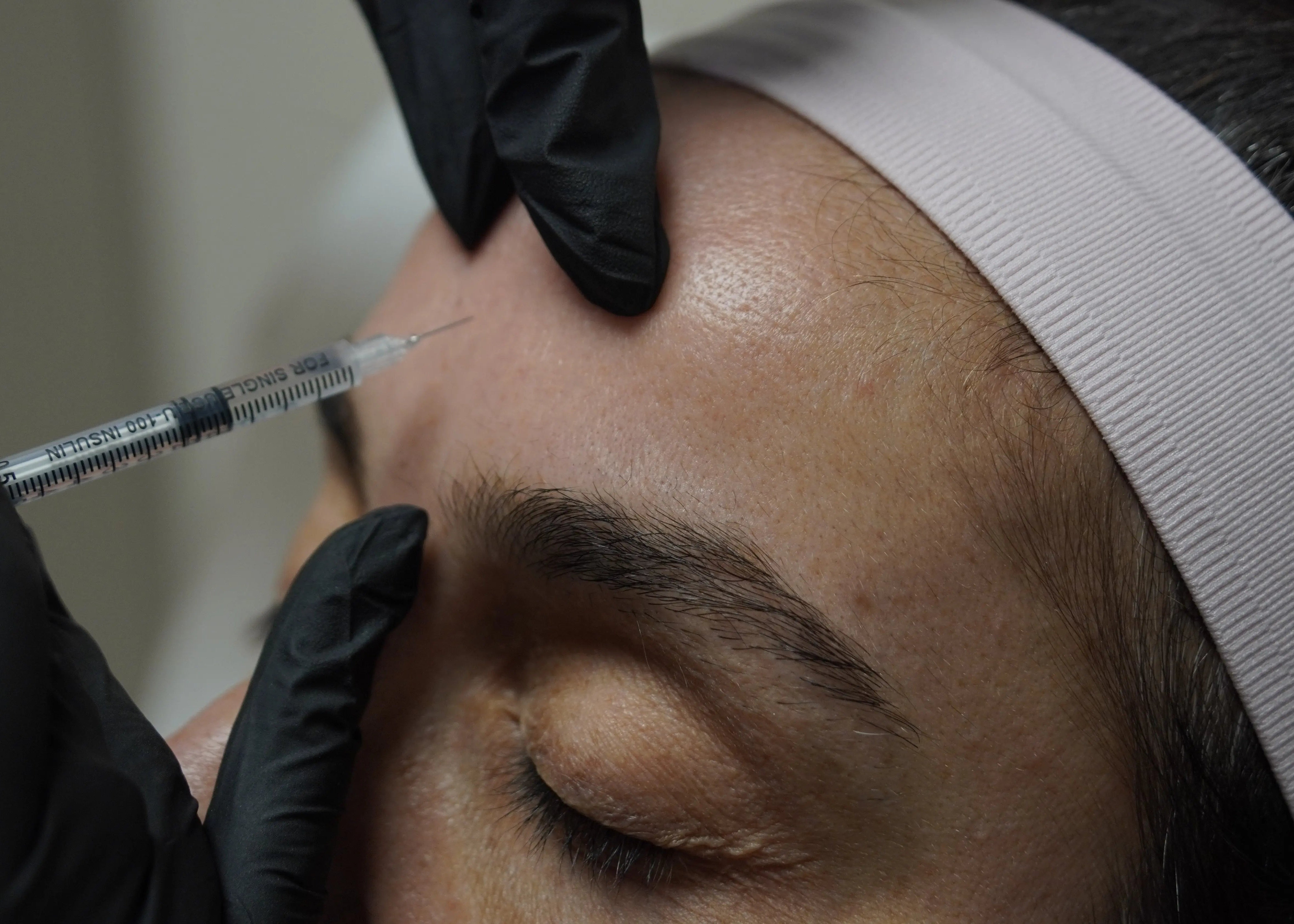 Person receiving a botox facial injection with a syringe held by gloved hands.