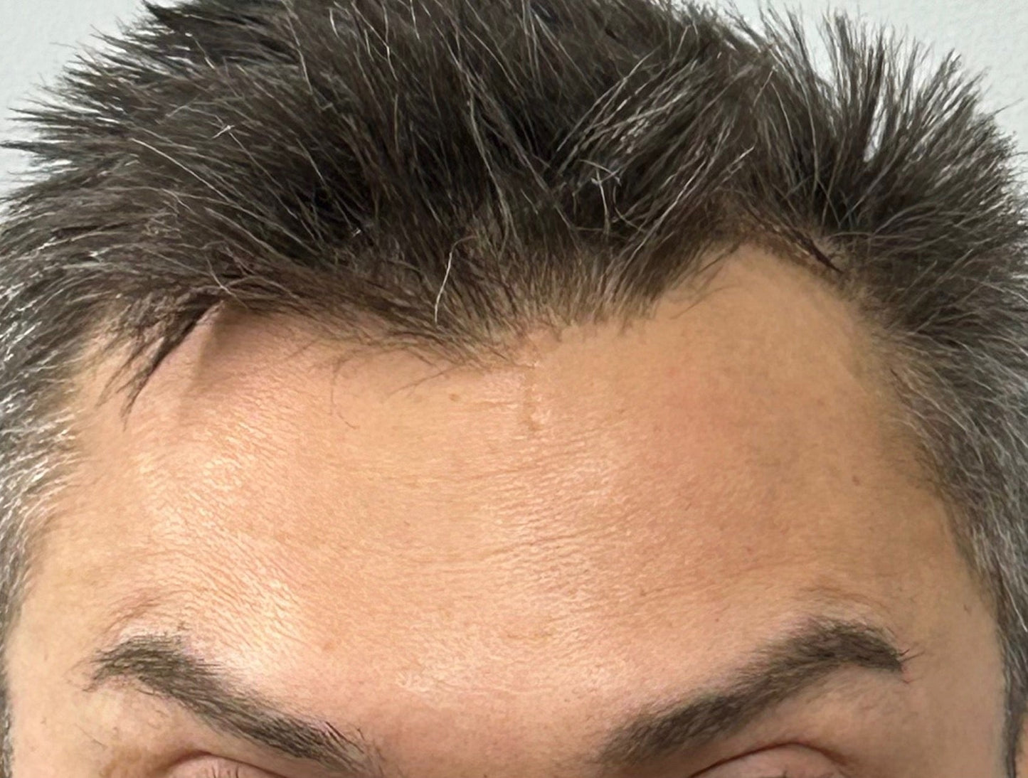 Wrinkle Reducer Treatment for Men 3 Areas