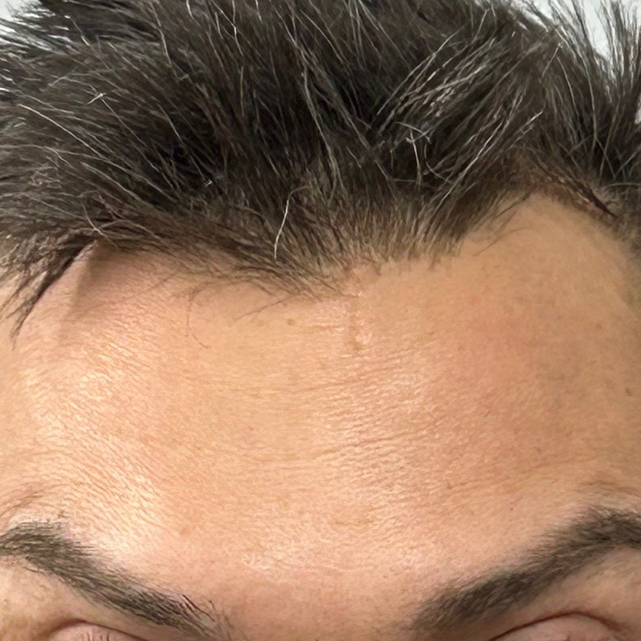 Wrinkle Reducer Treatment for Men 3 Areas