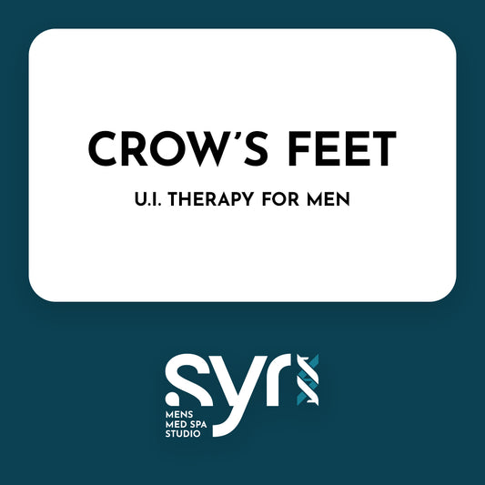 Ultherapy: Crow's Feet