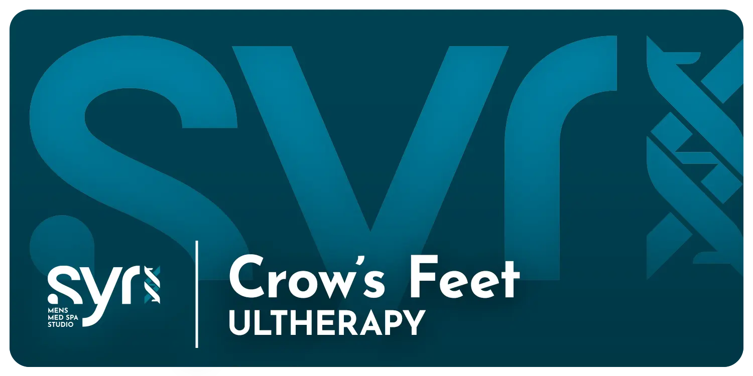 Ultherapy: Crow's Feet SYR Studio