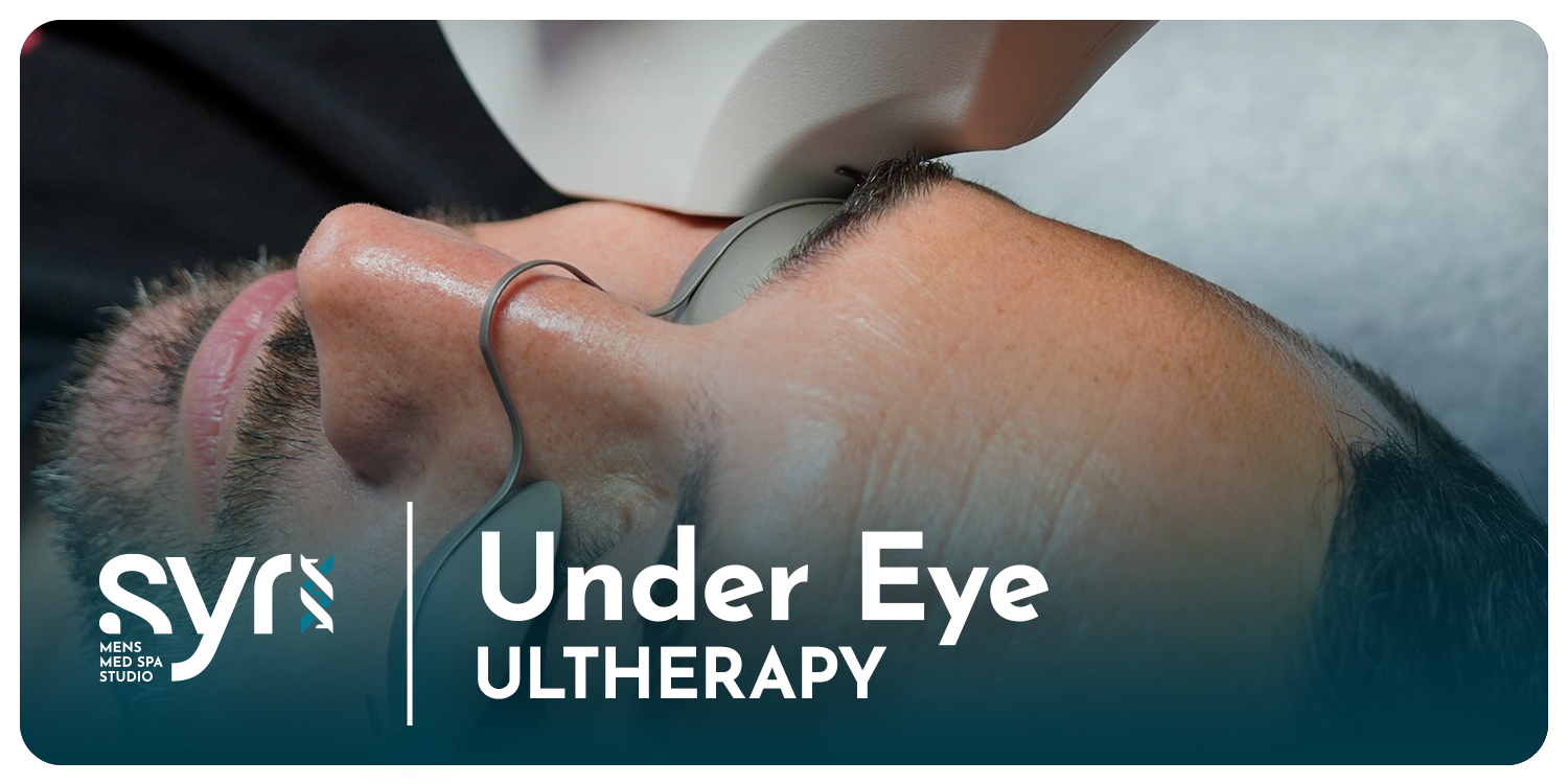 Ultherapy: Under Eye
