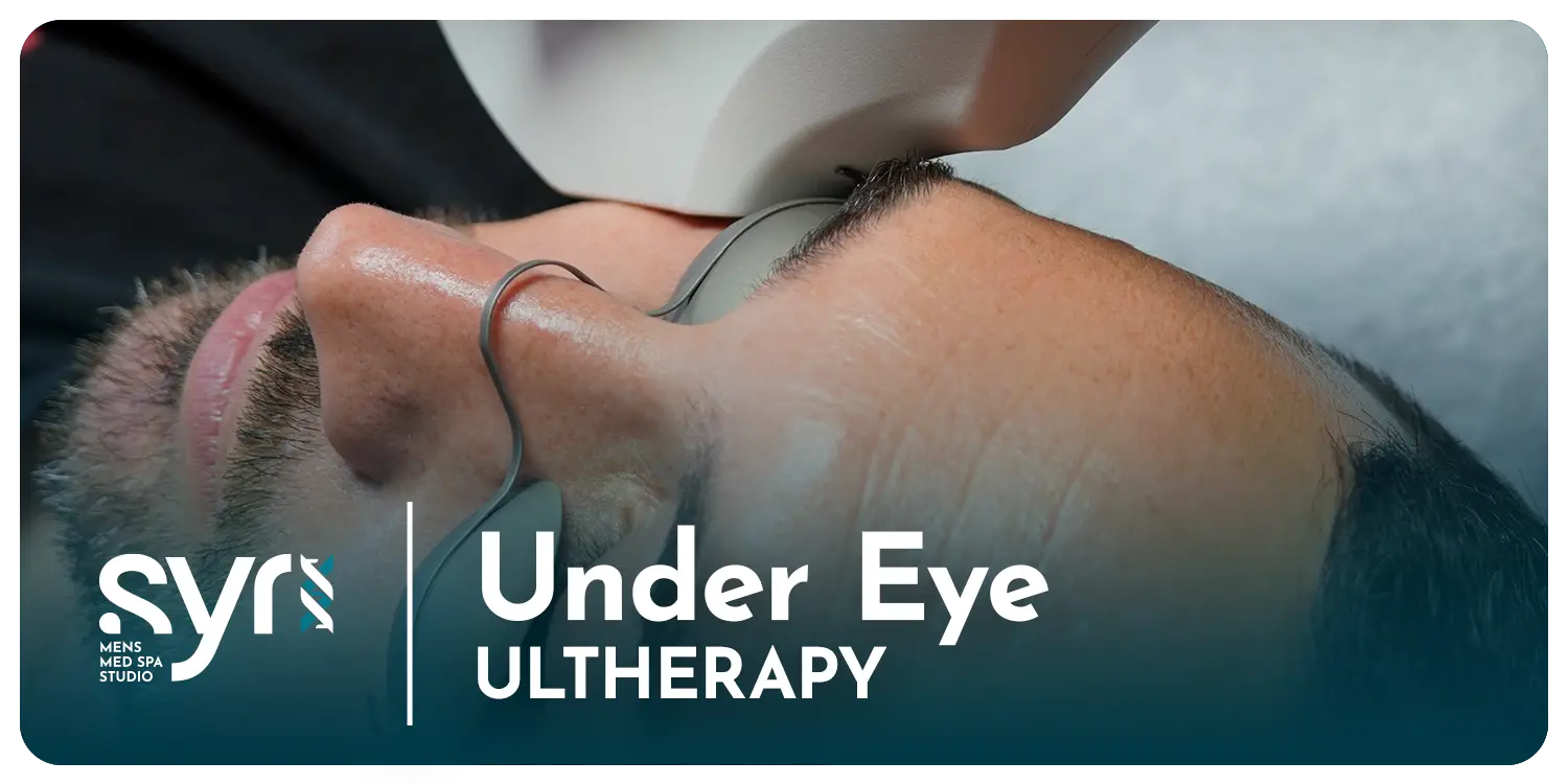 Ultherapy: Under Eye SYR Studio