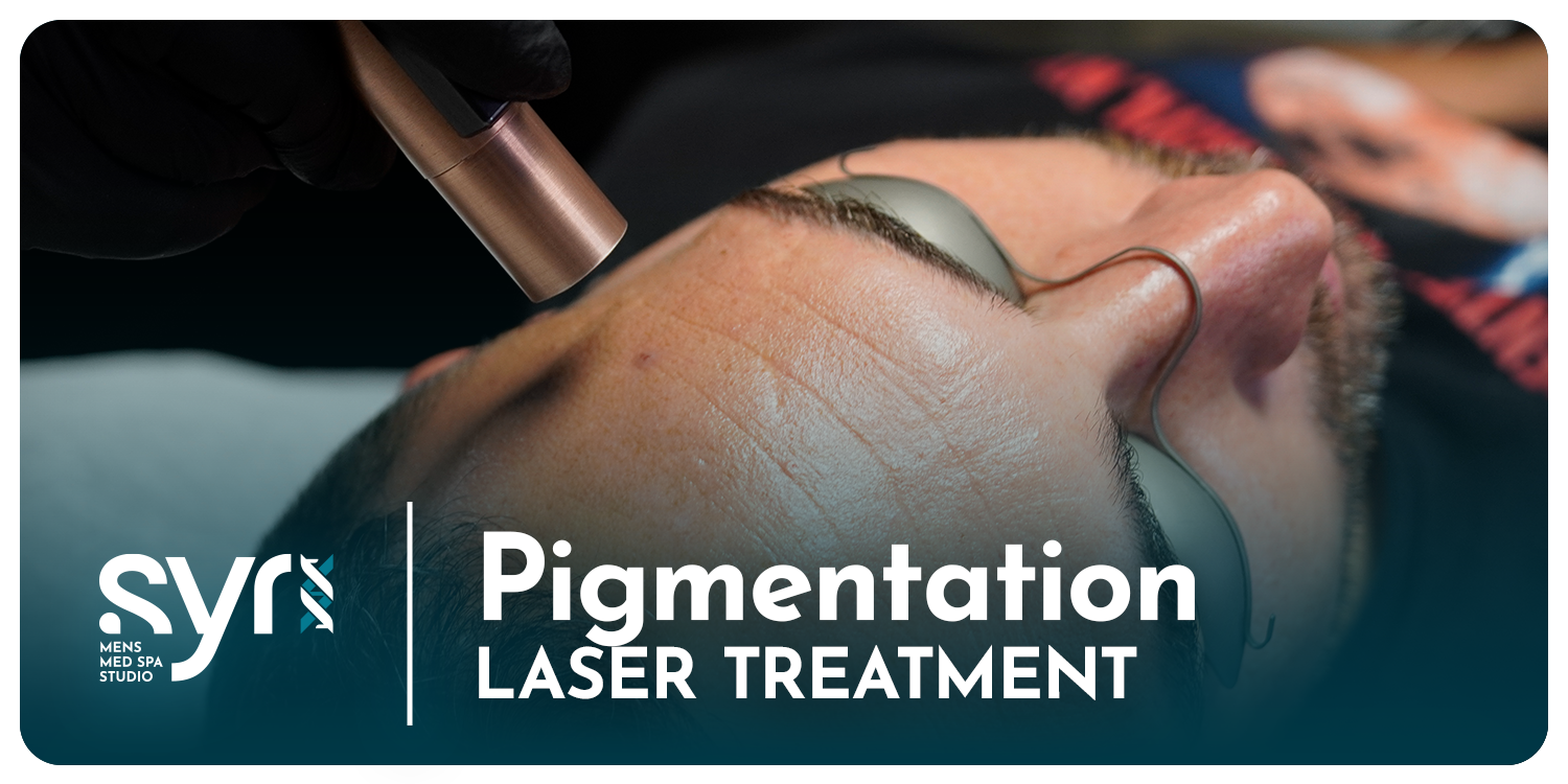 Laser Pigmentation Treatment for Men