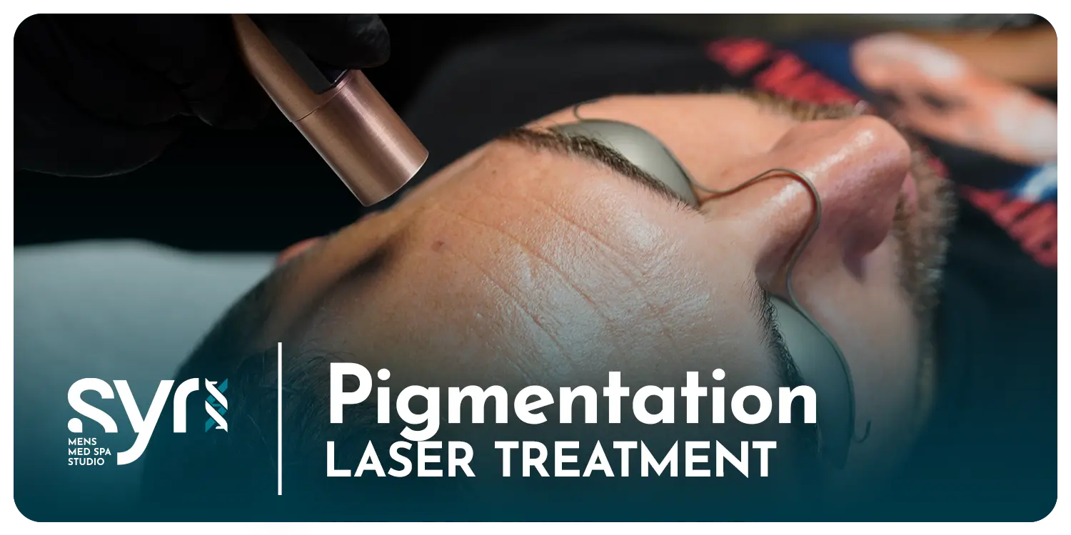 Laser Pigmentation Treatment for Men SYR X 4Her