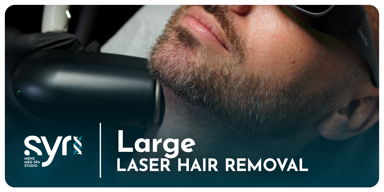 Large Treatment Area: Series of 6