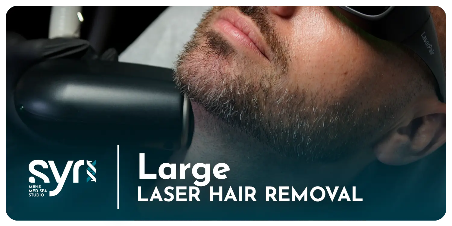 Large Treatment Area: Series of 6 SYR Studio