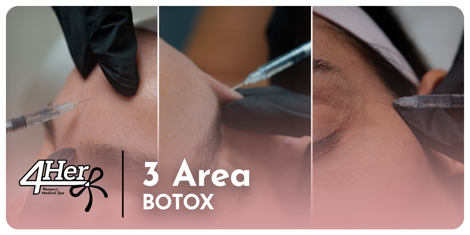 Botox for Women - 3 Areas
