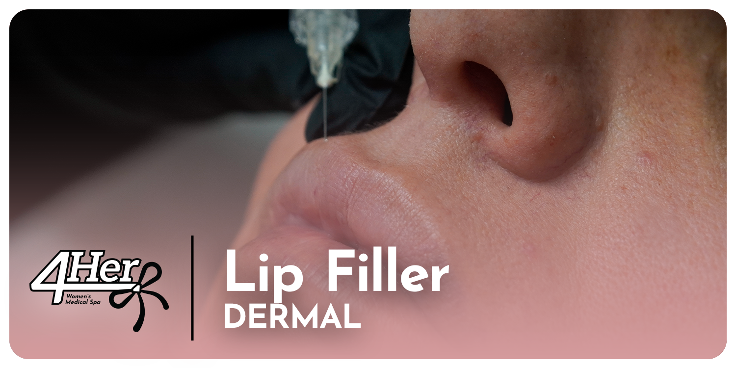 Lip Filler