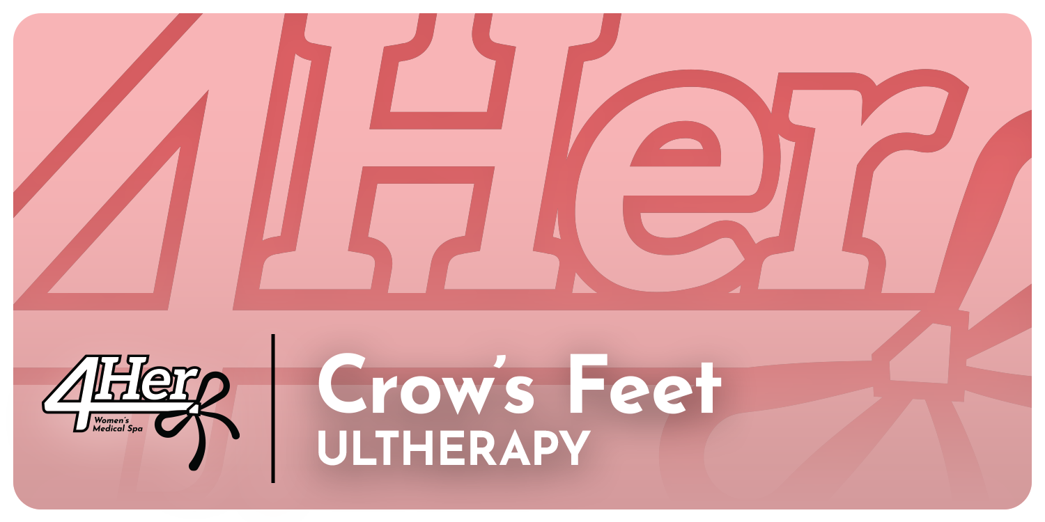 Ultherapy 4Her: Crow's Feet
