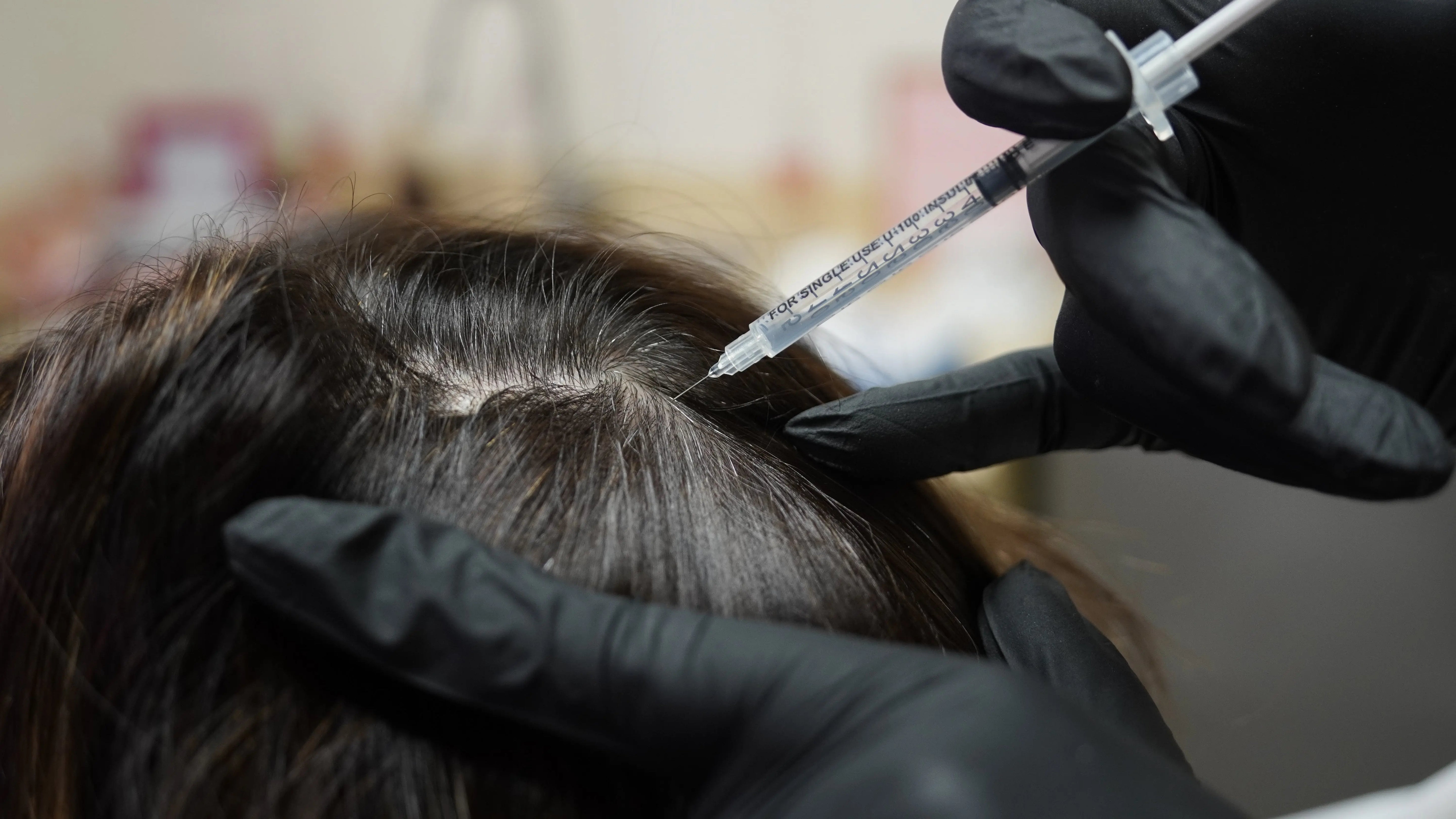 Hair Density Portfolio - SYR X 4Her