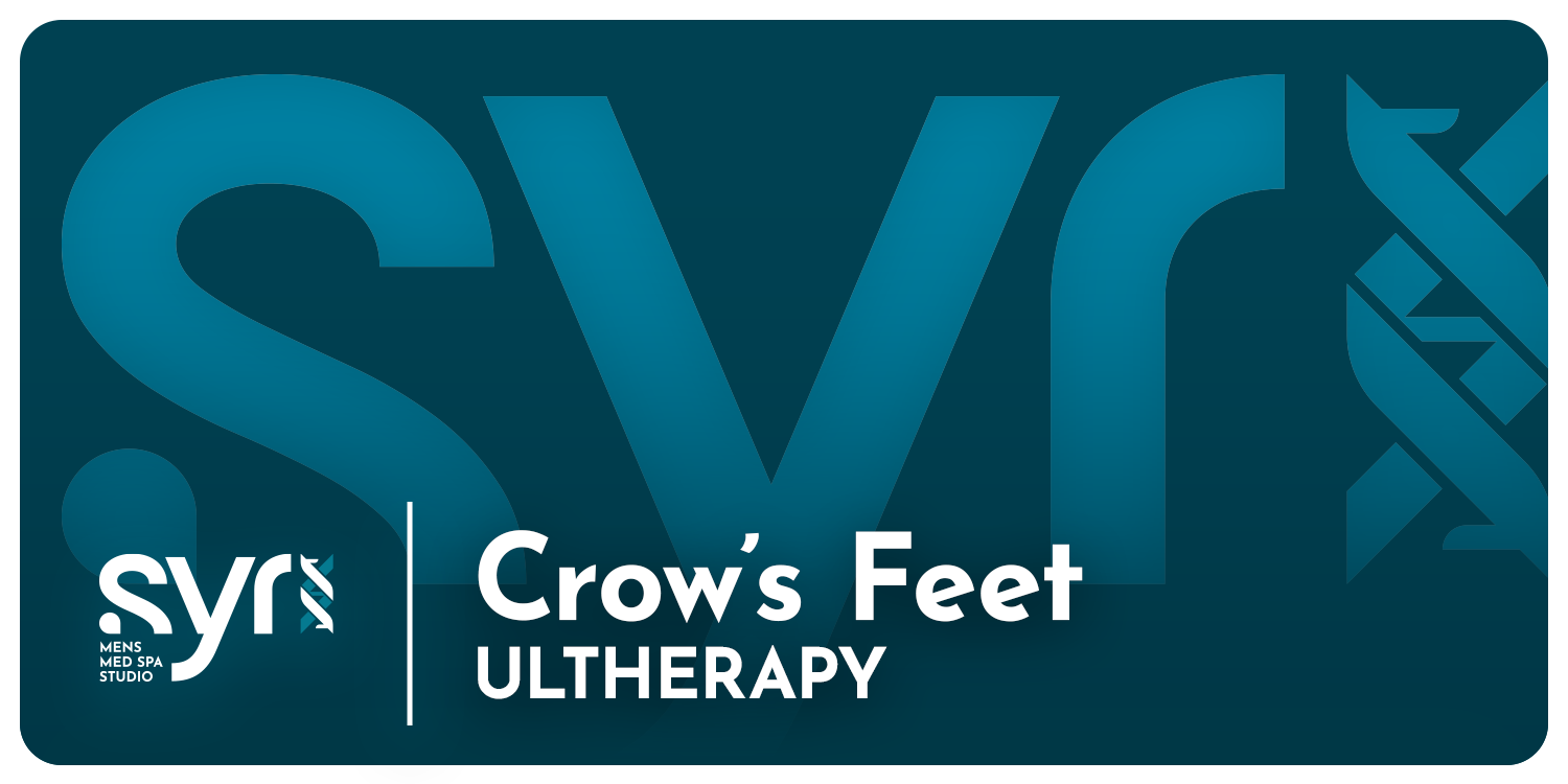 Ultherapy: Crow's Feet