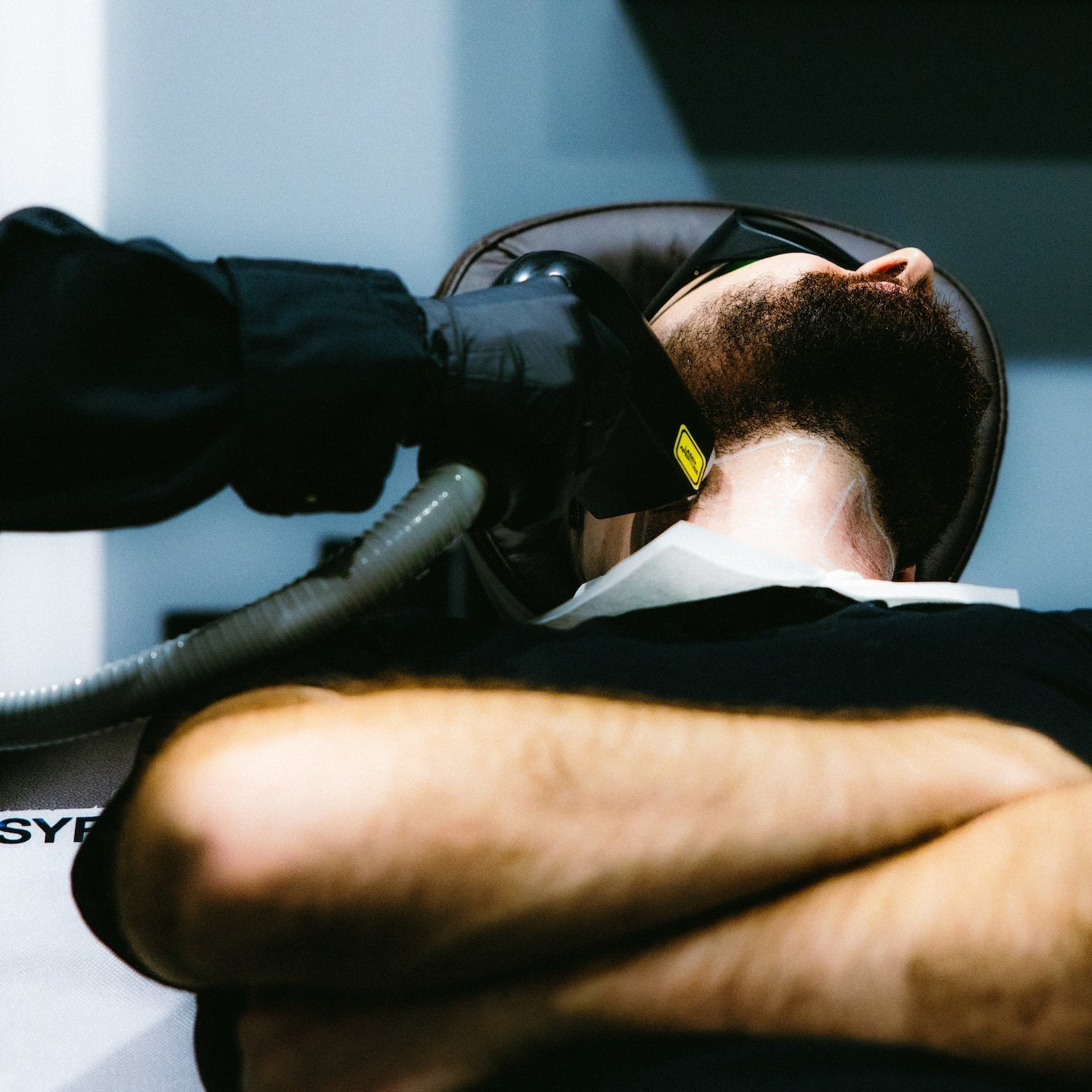 Laser Barbering- Beard 6 Sessions
