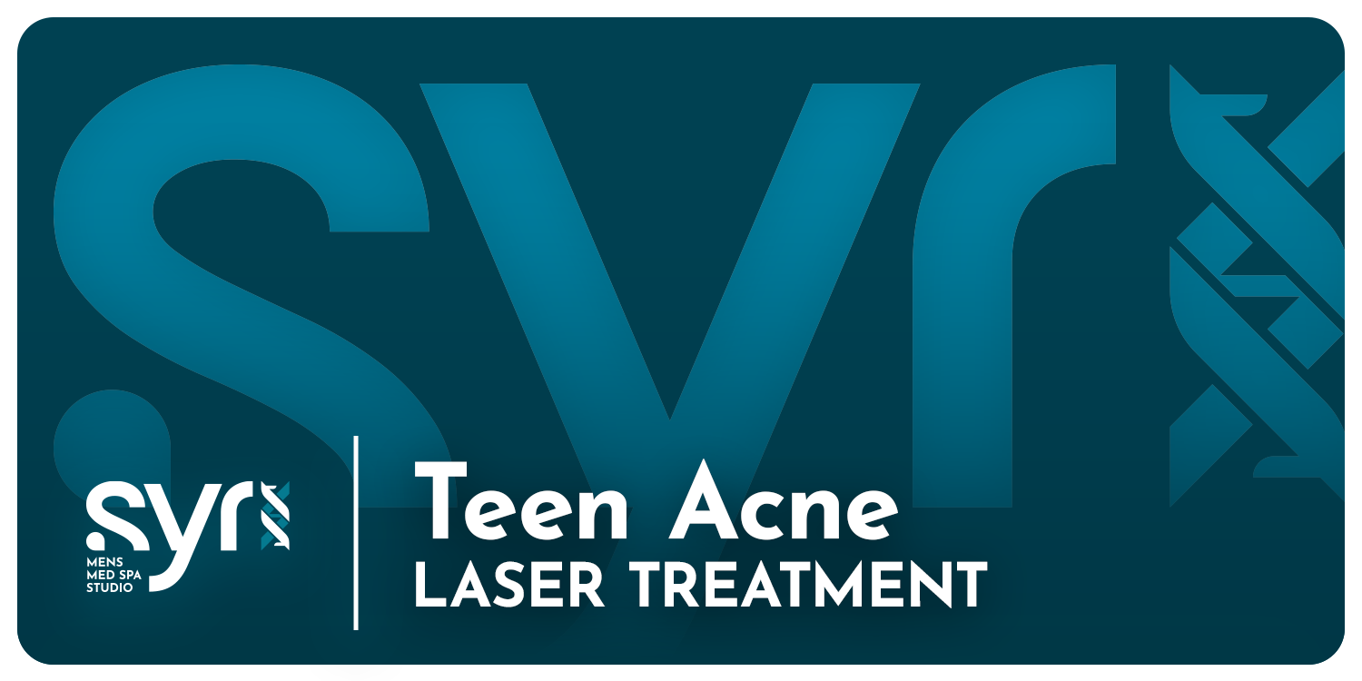 Teen Acne Laser Treatment for Boys